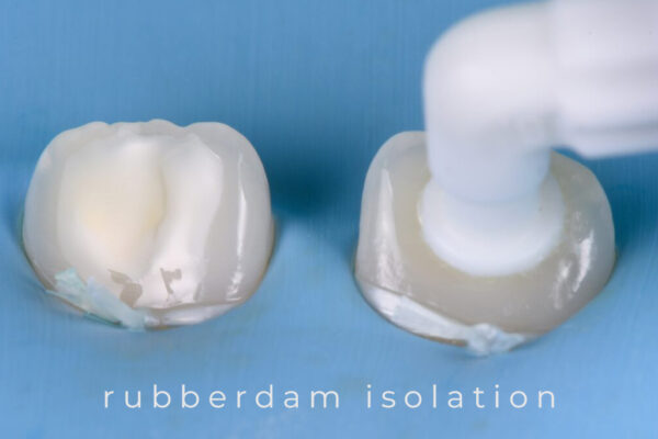 karma-dentistry-courses-infiltration-2