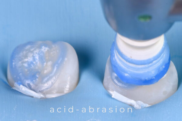 karma-dentistry-courses-infiltration-3